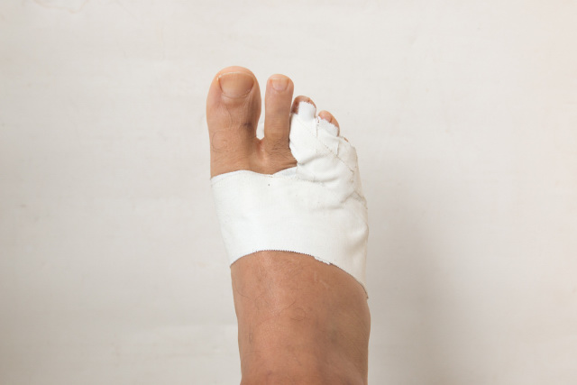 Foot of a man with a bandaged broken toe.